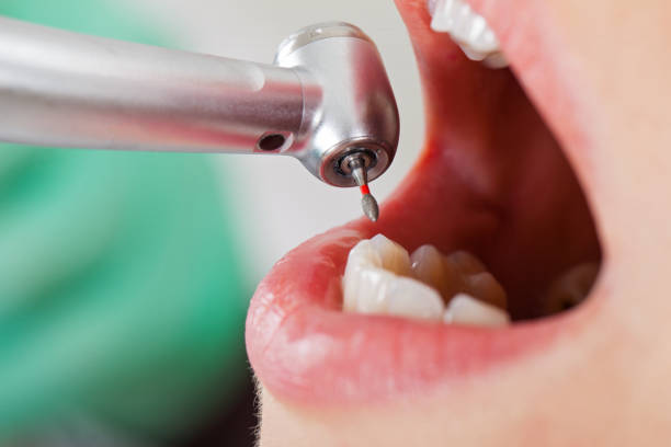 Best Emergency Dentist for Special Needs Patients in Kosciusko, MS